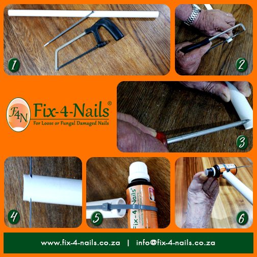 Fix 4 Nails - nail fungus treatment