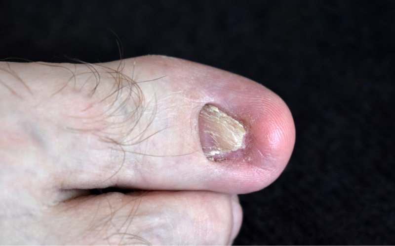 Nail Beauty Products | Reversing Damaged Nails